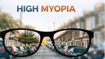high myopia